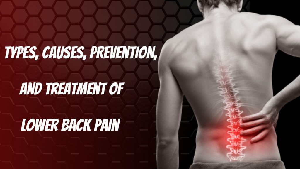 Types, Causes, Prevention, And Treatment of Lower Back Pain